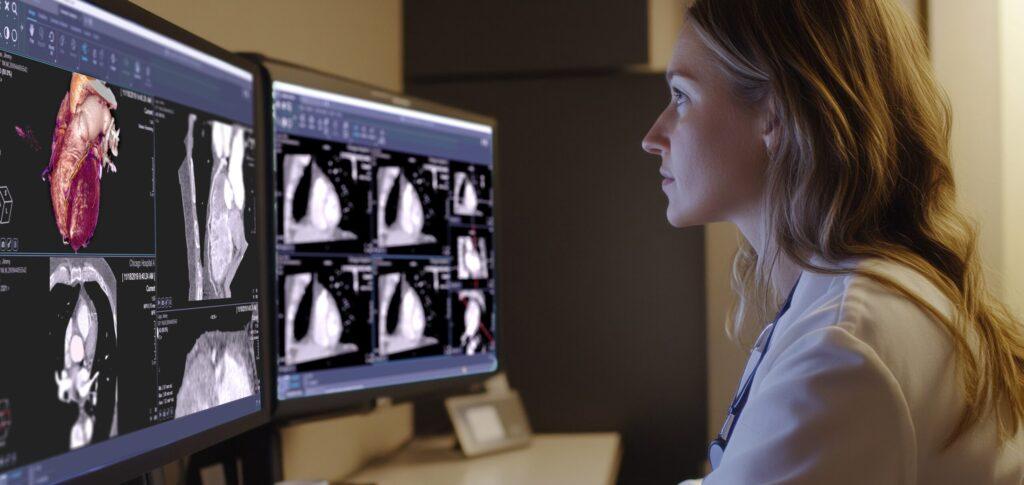 Visor de diagnóstico basado en la web de última generación que transforma la forma en que los radiólogos acceden e interpretan las imágenes médicas - Philips