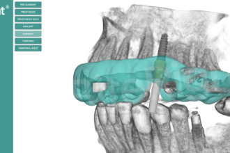 Visor 3D con hueso BiteRight Digital Platform