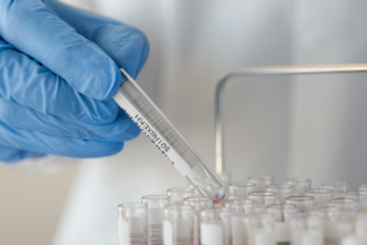 Investigación clínica Roche Farma en España - © Imagen de F. Hoffmann-La Roche
