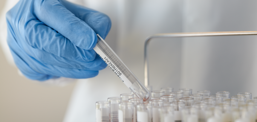 Investigación clínica Roche Farma en España - © Imagen de F. Hoffmann-La Roche